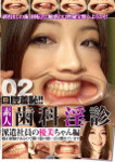 Grace Chan shyness mouth! Temporary staff of Photo / amateur digital dental 淫診