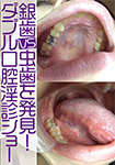 Discover silver teeth vs caries! Hitomi of double oral obscene diagnosis show / Otsuka Riku & apparel clerk